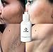 Organic Permanent Hair Growth Inhibitor (1 Pcs) - As Seen On TV AQISI