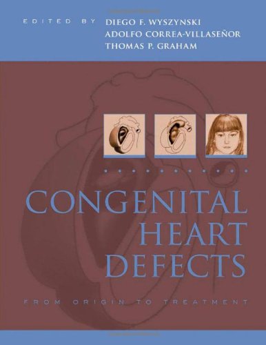 Congenital Heart Defects From Origin to Treatment (Hardcover)