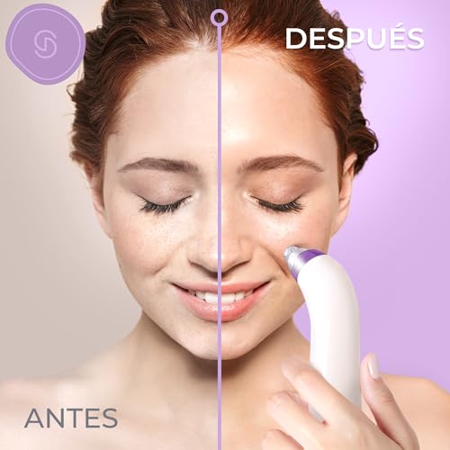 Essy Blackhead and Blackhead Sucker for Facial Cleansing (Lilac) | Deep Pore Suction, 5 Adjustable Intensity Levels, Rechargeable, 4 Suction Heads Suitable For All Skin Types