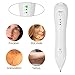 Habibee Portable USB Charging Freckle Dot Dark Spot Skin Tag and Mole Removal Pen Tattoo Remover Beauty Skin Machine