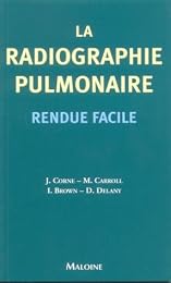 La  radiographie pulmonaire rendue facile