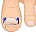 Gracefulvara Ingrown Toe Nail Correction Pedicure Wire Fixer Paronychia Recover Tool