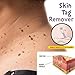 4PCS Skin Tag Wart Remover, Body Mole Warts Remover Body Warts Treatment Medical for Genital Warts, Moles, Skin Tags Remover Treatmentthumb 2