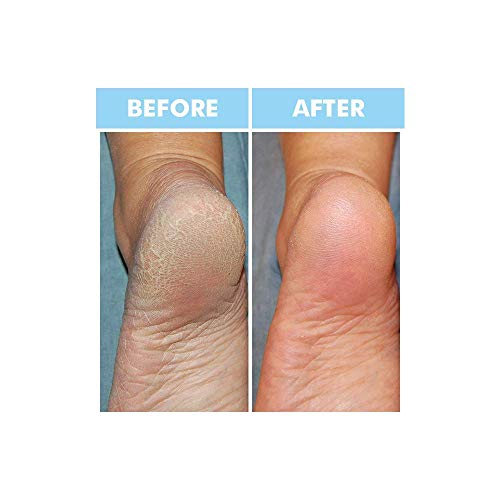 BODIPURE Premium Keratin Gloves and Socks Antiaging Moisturizing