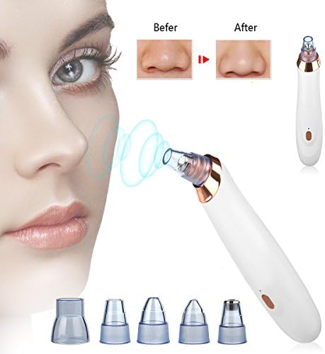 Blackhead Remover Wigbow Unisex Rechargeable Electric Facial Pore Cleaser Ultrasonic Sibration Vacuum Suction Machine Removes For Blackhead