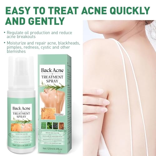 LBOYLOVE® Back Acne Treatment Spray – 2% Salicylic Acid & Hypochlorous Acid Spray for Body Acne, 120ml – Deep Cleansing, Fades Scars, Soothing Repair for Back, Chest & Shoulders