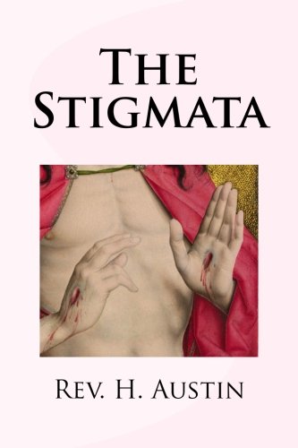 The Stigmata: A history of various cases.