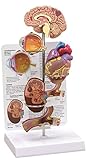 Hypertension Anatomical Organ Model Set- Brain, Eye, Heart, Kidney, Artery