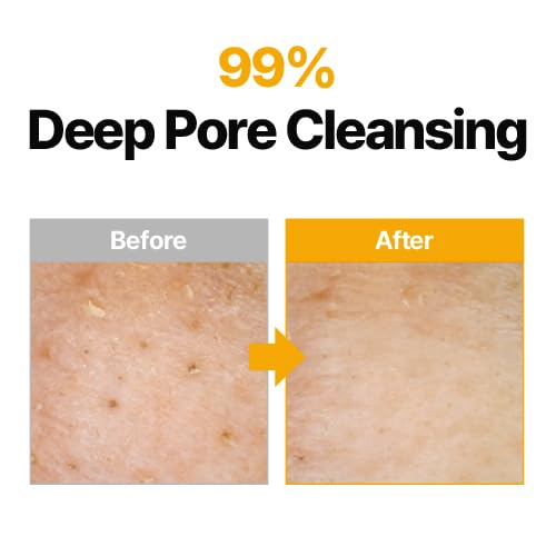 ma:nyo MANYO Pure Cleansing Oil, Natural Oil Cleanser for Face, Makeup Blackhead Remover, Korean Skin Care, 6.76 fl oz (200ml)