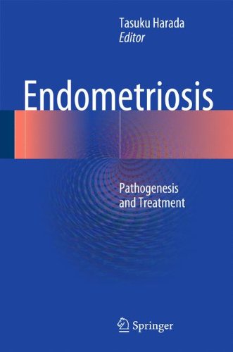 Endometriosis: Pathogenesis and Treatment