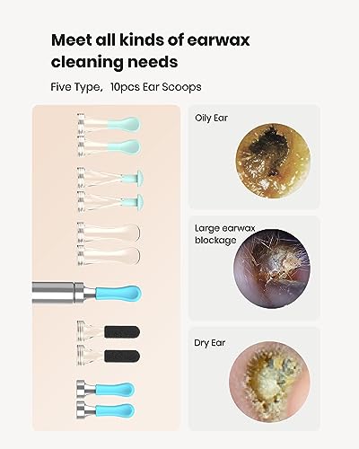 BEBIRD R1 Wax Removal Tool for Ear - Spade Ear Canal Cleaner with Camera 1080P Earscope, Wax Remove Ear Picker with Vari Replacement Tips, Camera with 6LED Light for Ear/Nose/Throat Examination, Black