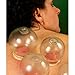 4 Cup Round Glass Fire Cupping Jars for Chinese Cupping Therapy and Massage