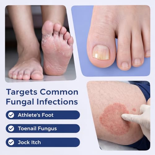 Athlete‘s Foot & Toenail Fungus Treatment Pen – Extra Strength Antifungal with 25% Undecylenic Acid, Maximum OTC, Precision Applicator for Itch Relief & Nail Care, Between Toes, 3 Pens + 5 Files