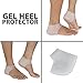 Plantar Fasciitis Relief Kit - Heel & arch pads, ankle brace & compression socks