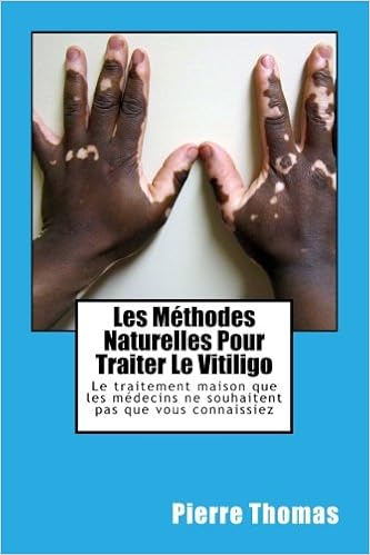 Amazon Fr Les Methodes Naturelles Pour Traiter Le Vitiligo Le Traitement Maison Que Les Medecins Ne Souhaitent Pas Que Vous Connaissiez Thomas Pierre Livres