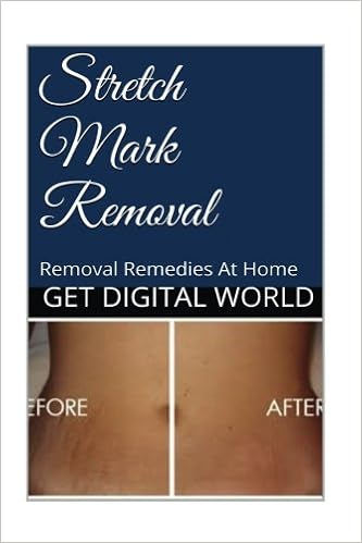 stretch mark removal amazon