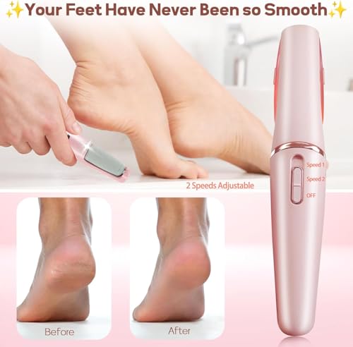 ZABOUL Electric Foot File,Professional Rechargeable Hard Skin Remover Foot Electric Kit for Dead Dry Cracked Callus Skin Heels,Effective Pedicure Tools with Replacement Roller Heads Storage Bag(Pink)