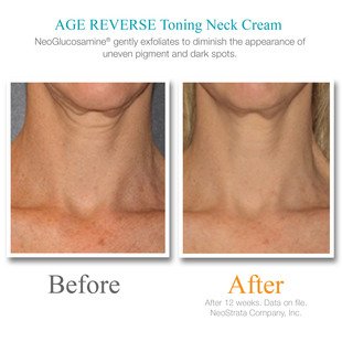 Exuviance Age Reverse Toning Neck Cream - 4.4 oz - Thumbnail 2