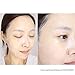 MOTHER MADE Moisturizing Snail Mucin Face Masks 20EA, 22,050ppm Snail Secretion Filtrate, Collagen, Niacinamide 2%, Vitamin C&E | Snail Serum Sheet Mask for Dry, Sensitive Skin, Korean Skincare