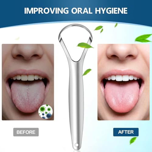 Brencco Steel Tongue Cleaner, Tongue Scraper with Case, 2 Pieces Tongue Nettaliser, Tongue Scraper for Oral Hygiene, Reusable Set