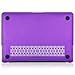 Kuzy Compatible with MacBook Air 13 inch Case 2020 2021 2018 MacBook Air M1 Case Hard Shell MacBook Air 2020 Case Cover A2337 MacBook Air Case A2179 A1932 Laptop Case MacBook Air 13 inch, Lace Purple