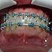 Dentalmall® 1 Pack Dental Orthodontic Ligature Ties Mixed Colors