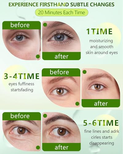 GLAMOUR RAPTURE 120 PCS CHLORELLA EYE PATCHES,COLLAGEN UNDER EYE MASK FOR PUFFY EYES & DARK CIRCLES, COMBAT FINE LINES AND WRINKLES,NON-IRRITATING UNDER EYE PATCHES
