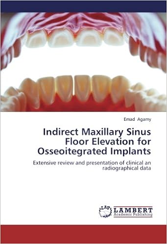 Indirect Maxillary Sinus Floor Elevation For Osseoitegrated