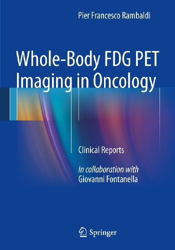 Download Whole-Body FDG PET Imaging in Oncology: Clinical Reports