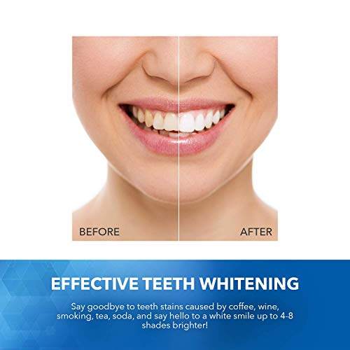 Aroamas Teeth Whitening Pen, 3 pack, Whitening Gel