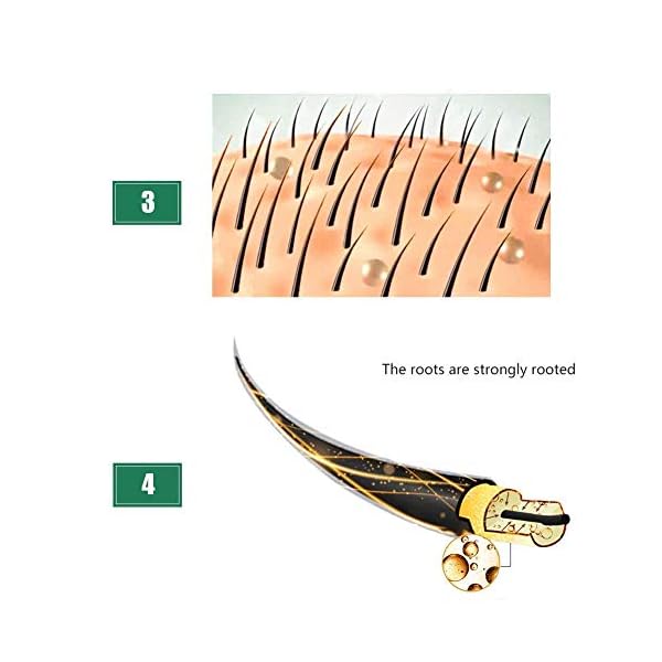 Ginger Germinal Oil, Hair Growth Oil, Hair Growth Serum, Ginger Germinal Essential Oil, Hair Loss Treatment Hair Care…