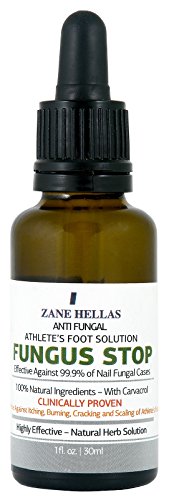 Fungus Stop. Anti Fungal Athletes Foot Solution. KILL 99.9% of FUNGUS. Relieves Itching, Burning, Cracking, Scaling. 1 oz - 30 ml