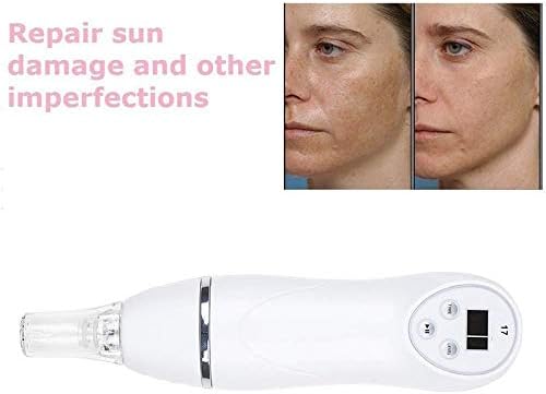 セール特価返品ok の B087jfynpx スキンケア 基礎化粧品 真空ブラックヘッドリムーバーダイヤモンド皮膚剥離吸引毛穴クリーナースキンケア美容フェイシャル クリーン鼻ゾーン黒い点の抽出 ビューティー 真空ブラックヘッドリムーバーダイヤモンド皮膚剥離吸引毛穴