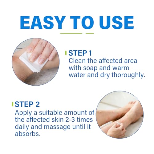 Skin Fungus Cream, Foot Fungus Relief Quick Intensive, Antibody Ringworm, Eczema, Sweat Bubbles, Non-Irritating, Suitable for Face and Body Care, 60 g