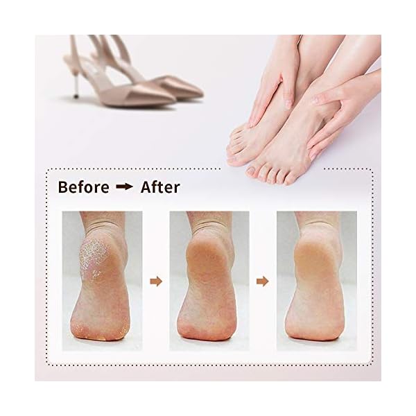 Electric-Foot-File-DIOZO-Rechargeable-Waterproof-Hard-Skin-Remover-with-3-Rollers-and-2-speeds-Remove-Cracked-Heels-and-Dead-Skin-Within-Minutes Electric Foot File, DIOZO Rechargeable Waterproof Hard Skin Remover with 3 Rollers and 2 speeds, Remove Cracked Heels…