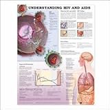 Understanding HIV and AIDS Anatomical Chart, Anatomical Chart Company Staff, 1587798530