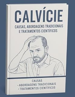 Livro Calvície: Causas, Abordagens Tradicionais e Tratamentos Científicos