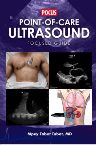 Point of Care Ultrasound: 9780323544702: Medicine & Health Science