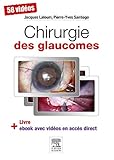Chirurgie Des Glaucomes (French Edition) by Jacques Laloum