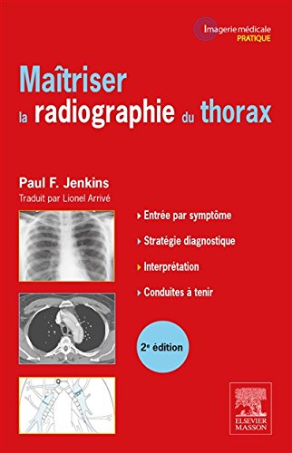Maîtriser la radiographie du thorax