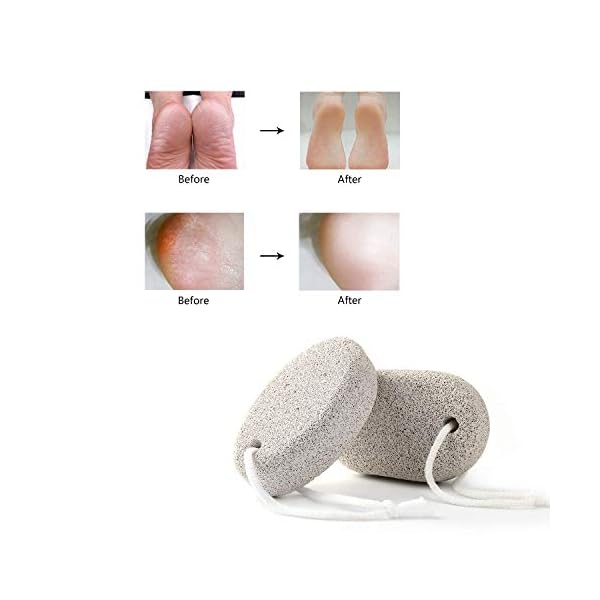 Natural-Pumice-Stone-for-Feet-2-PCS-Phogary-Lava-Pedicure-Tools-Hard-Skin-Callus-Remover-for-Feet-and-Hands-Natural-Foot-File-Exfoliation-to-Remove-Dead-Skin Natural Pumice Stone for Feet 2 PCS, PHOGARY Lava Pedicure Tools Hard Skin Callus Remover for Feet and Hands - Natural…