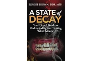 A State of Decay: Your Dental Guide to Understanding and Treating "Meth Mouth"