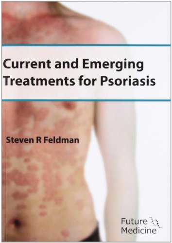 Current and Emerging Treatments for Psoriasis