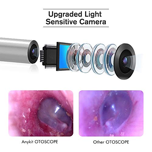 Otoscope iPhone, Anykit Upgraded 4.3mm 720P HD Ear Scope Camera Digital Otoscope with 6 LED Lights, Earwax Removal Tool and Specula for iPhone and Android Smartphone - Thumbnail 7