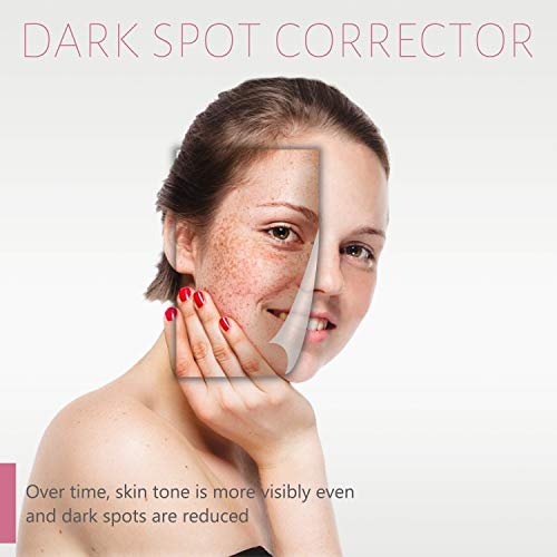 Dark Spot Corrector for Face，Dark Spot Remover for Face and Body，Age Spot Dark Spot Serum Cream Helps fade hyperpigmentation, melasma,freckles,age spots,sun spot and post acne marks.