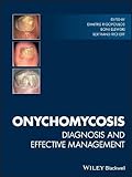 Onychomycosis - Diagnosis and Effective Management