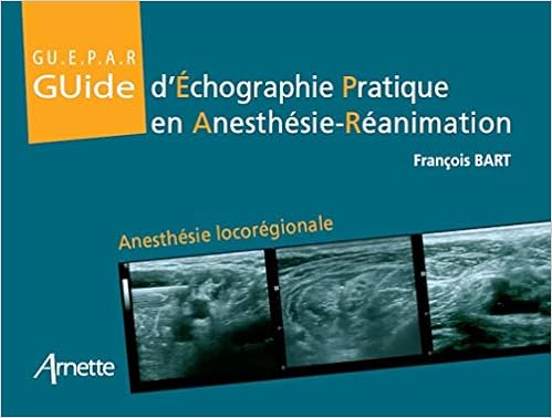 Amazon Fr Guide D Echographie Pratique En Anesthesie Reanimation Anesthesie Locoregionale Francois Bart Elisabeth Gaertner Livres