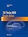 7.0 Tesla MRI Brain Atlas: In-vivo Atlas with Cryomacrotome Correlation