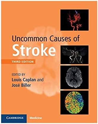 Decision Making in Neurovascular Disease: 9781684200573: Medicine