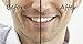 Teeth Whitening Strips - Instantly Whiter Brighter Teeth - Best Whitener Available - 28 Treatments - Makes Every Tooth as White as Possible